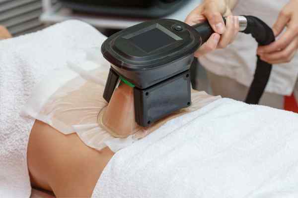 Areas of the Body we treat Cryolipolysis Epping