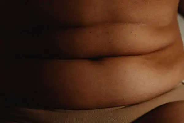The Hidden Connection: How Stress Shapes Your Fitness and Body Composition 3 image of what stress can do on the stomach area and how Lipo 360 Epping can help to change your body shape.