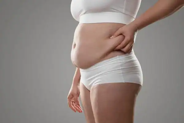 Image of stress belly Epping How Lipo 360 can help manage your symptoms